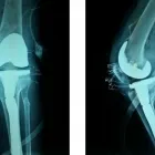 La imagen 4 de la Empresa PRÓTESIS DE CADERA Y CIRUGÍA DE RODILLA EN GUADALAJARA Salud y Medicina en Guadalajara JAL