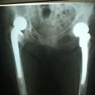 La imagen 2 de la Empresa RADIOGRAFIAS A DOMICILIO Salud y Medicina en Ciudad De México CMX