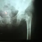La imagen 3 de la Empresa RADIOGRAFIAS A DOMICILIO Salud y Medicina en Ciudad De México CMX