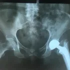 La imagen 4 de la Empresa RADIOGRAFIAS A DOMICILIO Salud y Medicina en Ciudad De México CMX