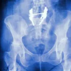 La imagen 5 de la Empresa RADIOGRAFIAS A DOMICILIO Salud y Medicina en Ciudad De México CMX