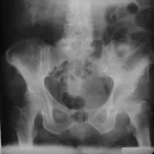 La imagen 8 de la Empresa RADIOGRAFIAS A DOMICILIO Salud y Medicina en Ciudad De México CMX