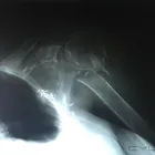 La imagen 10 de la Empresa RADIOGRAFIAS A DOMICILIO Salud y Medicina en Ciudad De México CMX