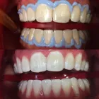 La imagen 11 de la Empresa SABA DENTAL Salud y Medicina en Zapopan JAL