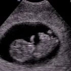 La imagen 3 de la Empresa SONOGRAFIA ESPECIALIZADA Salud y Medicina en Niños Héroes CHH