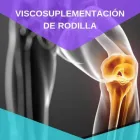La imagen 1 de la Empresa TRAUMATOLOGÍA Y ORTOPEDIA INTEGRAL DR. VÍCTOR BARBOSA ONESTO Salud y Medicina en Irapuato GUA