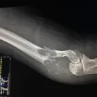 La imagen 3 de la Empresa TRAUMATOLOGÍA Y ORTOPEDIA JARDINES DEL BOSQUE Salud y Medicina en Guadalajara JAL