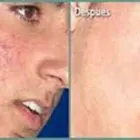 La imagen 1 de la Empresa UNIDAD MÉDICA DERMATOLÓGICA Salud y Medicina en Mexicali BCN