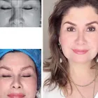 La imagen 2 de la Empresa VANITY COSMETOLOGIA Salud y Medicina en Tijuana BCN