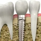 La imagen 1 de la Empresa WORLD SMILE Salud y Medicina en Ciudad Juárez CHH