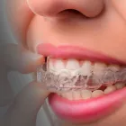 La imagen 1 de la Empresa ZAMUDIO DENTAL Salud y Medicina en Puerto Vallarta JAL