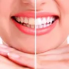 La imagen 2 de la Empresa ZAMUDIO DENTAL Salud y Medicina en Puerto Vallarta JAL