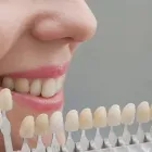 La imagen 3 de la Empresa ZAMUDIO DENTAL Salud y Medicina en Puerto Vallarta JAL