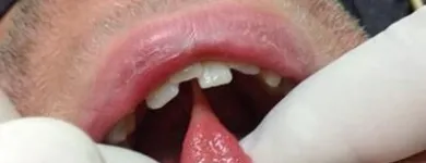 La imagen 3 de la Empresa ARTE DENTAL ESSEX Salud y Medicina en La Paz BCS