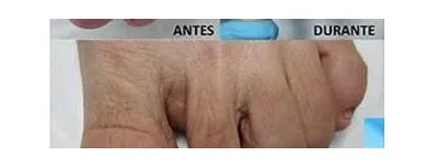 La imagen 1 de la Empresa CLÍNICA DE LOS PIES DE MEXICALI Salud y Medicina en Mexicali BCN