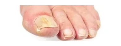 La imagen 2 de la Empresa CLÍNICA DE LOS PIES DE MEXICALI Salud y Medicina en Mexicali BCN