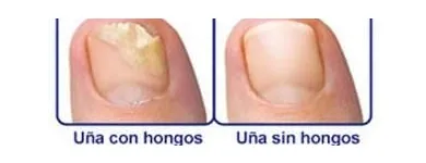 La imagen 3 de la Empresa CLÍNICA DE LOS PIES DE MEXICALI Salud y Medicina en Mexicali BCN