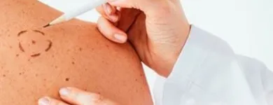 La imagen 2 de la Empresa DERMATOLOGÍA INTEGRAL Salud y Medicina en Tepic NAY