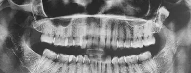 La imagen 2 de la Empresa DIAGNÓSTICO MÉDICO DENTAL POR IMAGEN SC Salud y Medicina en Ciudad Juárez CHH