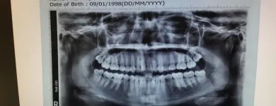 La imagen 1 de la Empresa DR. ABEL F. MILLAN CIRUJANO MAXILOFACIAL Salud y Medicina en Culiacán SIN