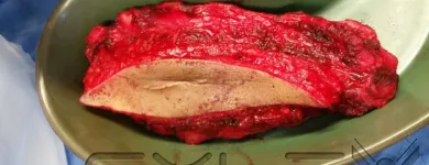 La imagen 1 de la Empresa DR.ARMANDO BASILIO ROQUE CIRUJANO ONCOLOGO Salud y Medicina en Puebla MEX