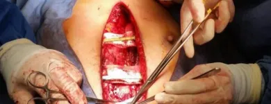 La imagen 2 de la Empresa DR.ARMANDO BASILIO ROQUE CIRUJANO ONCOLOGO Salud y Medicina en Puebla MEX