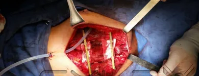 La imagen 3 de la Empresa DR.ARMANDO BASILIO ROQUE CIRUJANO ONCOLOGO Salud y Medicina en Puebla MEX