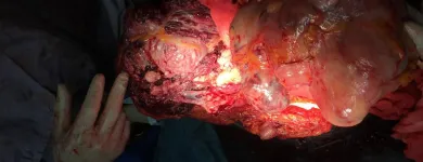 La imagen 4 de la Empresa DR.ARMANDO BASILIO ROQUE CIRUJANO ONCOLOGO Salud y Medicina en Puebla MEX