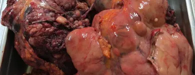 La imagen 5 de la Empresa DR.ARMANDO BASILIO ROQUE CIRUJANO ONCOLOGO Salud y Medicina en Puebla MEX