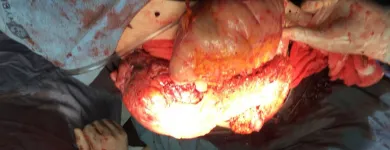 La imagen 6 de la Empresa DR.ARMANDO BASILIO ROQUE CIRUJANO ONCOLOGO Salud y Medicina en Puebla MEX