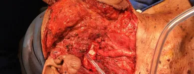 La imagen 7 de la Empresa DR.ARMANDO BASILIO ROQUE CIRUJANO ONCOLOGO Salud y Medicina en Puebla MEX