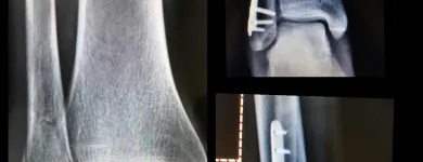 La imagen 1 de la Empresa DR. ESTEBAN CASTRO CONTRERAS TRAUMATÓLOGO Y ORTOPEDISTA Salud y Medicina en Guadalajara JAL