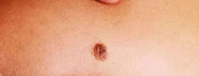 La imagen 3 de la Empresa DR FRANCISCO GAMEZ CUADRAS Salud y Medicina en Tepic NAY