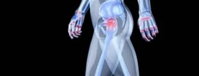 La imagen 3 de la Empresa DR. J. SANTOS DURÁN ORTIZ Salud y Medicina en Tepic NAY