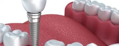 La imagen 2 de la Empresa DR. JORGE MARTINEZ V. Salud y Medicina en Mexicali BCN