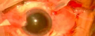 La imagen 3 de la Empresa DR. JOSÉ MANUEL GONZÁLEZ MALDONADO Salud y Medicina en Celaya GUA