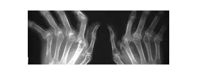 La imagen 1 de la Empresa DR JUAN RAMÓN MEDINA Salud y Medicina en Tijuana BCN