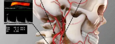 La imagen 4 de la Empresa DR. MISHELL SANTANDER BECERRA, ANGIÓLOGO Salud y Medicina en San Andrés Cholula PUE