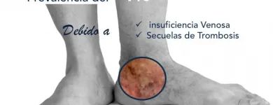 La imagen 7 de la Empresa DR. MISHELL SANTANDER BECERRA, ANGIÓLOGO Salud y Medicina en San Andrés Cholula PUE