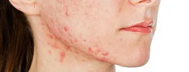 La imagen 1 de la Empresa DRA. GISELA RODRIGUEZ VOIROL Salud y Medicina en Morelia MIC