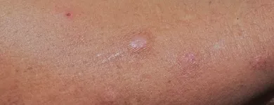 La imagen 1 de la Empresa DRA. MARY ANN WEAVER VELASCO Salud y Medicina en Queretaro QUE