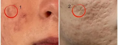 La imagen 2 de la Empresa DRA. MARY ANN WEAVER VELASCO Salud y Medicina en Queretaro QUE