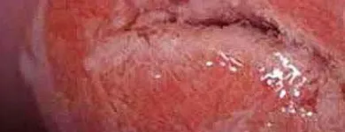 La imagen 1 de la Empresa DRA YUCKARI CARBAJAL JIMÉNEZ Salud y Medicina en Poza Rica VER