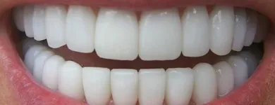 La imagen 5 de la Empresa IMPLANT-E! DENTAL Salud y Medicina en Monterrey NLE