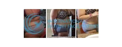 La imagen 4 de la Empresa INTERNATIONAL PATIENT FACILITATORS Salud y Medicina en Tijuana BCN