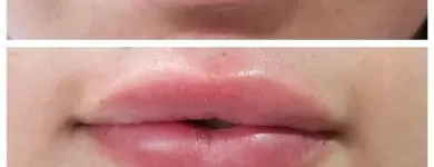 La imagen 2 de la Empresa MEDIESTETIC Salud y Medicina en Ciudad Juárez CHH