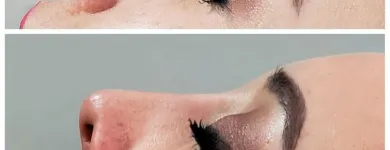 La imagen 3 de la Empresa MEDIESTETIC Salud y Medicina en Ciudad Juárez CHH