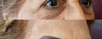 La imagen 1 de la Empresa MEDIESTÉTICA ACAPULCO Salud y Medicina en Acapulco GRO