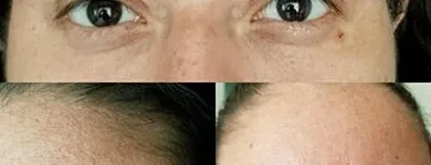 La imagen 3 de la Empresa MEDIESTÉTICA ACAPULCO Salud y Medicina en Acapulco GRO