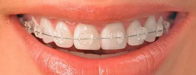 La imagen 2 de la Empresa ORTHOAESTHETIC Salud y Medicina en Ciudad De México CMX